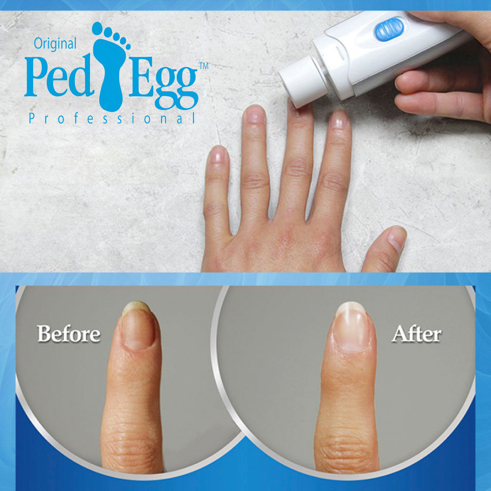 Ped Egg Bare Nails