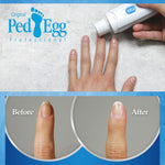 Ped Egg Bare Nails